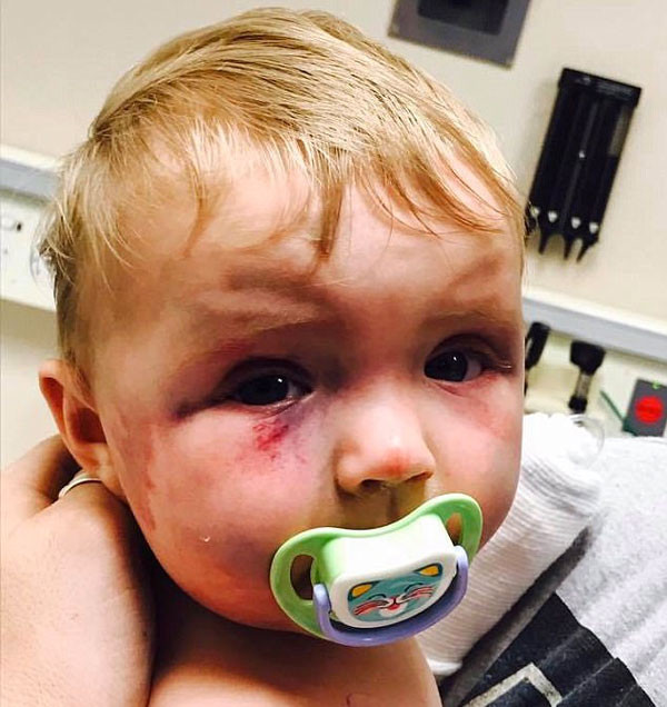 Vicdansız anne bebeğini kendi elleriyle bu hale getirdi sonrası korkunç - Resim: 1