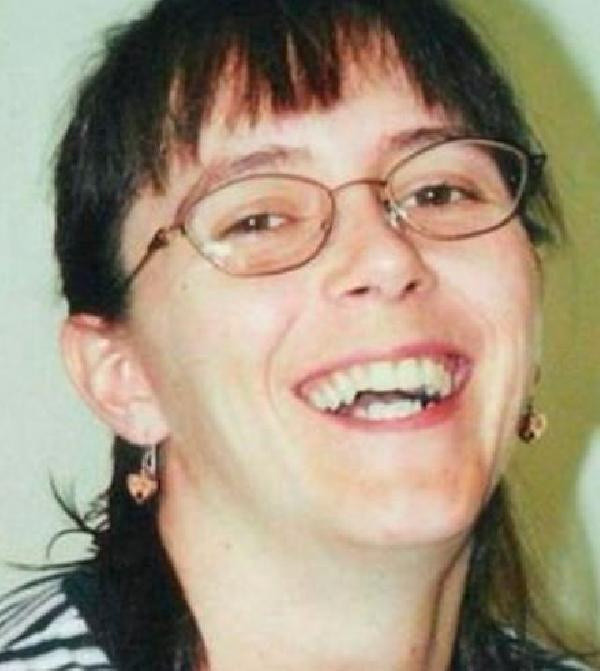 Kocası yüzüne kimyasal madde attı ikinci kez yüz nakli yapıldı! İşte son hali - Resim: 1