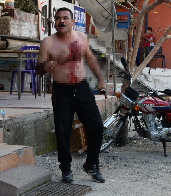 Polisi görünce kendine bunu yaptı! - Resim: 2