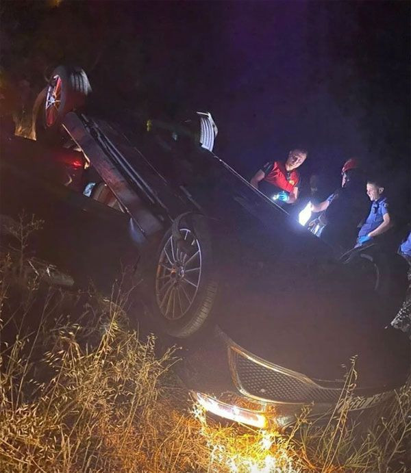 Bodrum'da kaza yapmış ağır yaralanmıştı! Ünlü model korkunç kazanın detaylarını anlattı "Bilerek kolumu kırdım" - Resim: 3