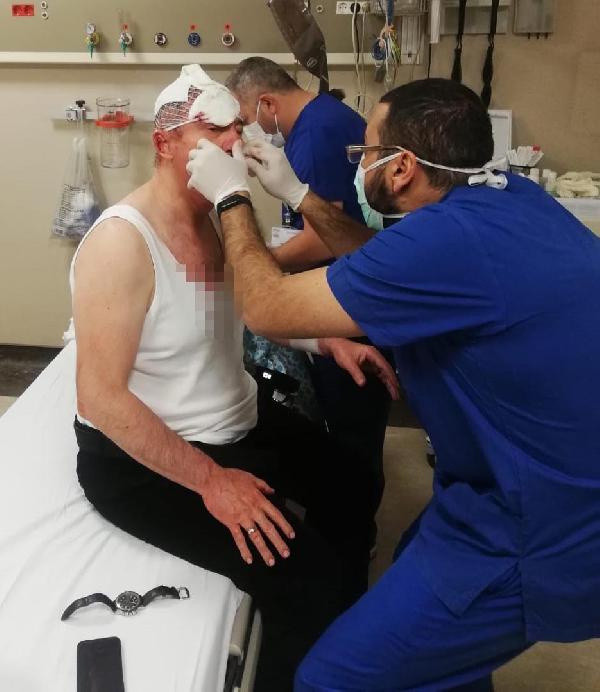 Gazeteci Uğuroğlu'na saldırıda 4 kişi serbest - Resim: 0