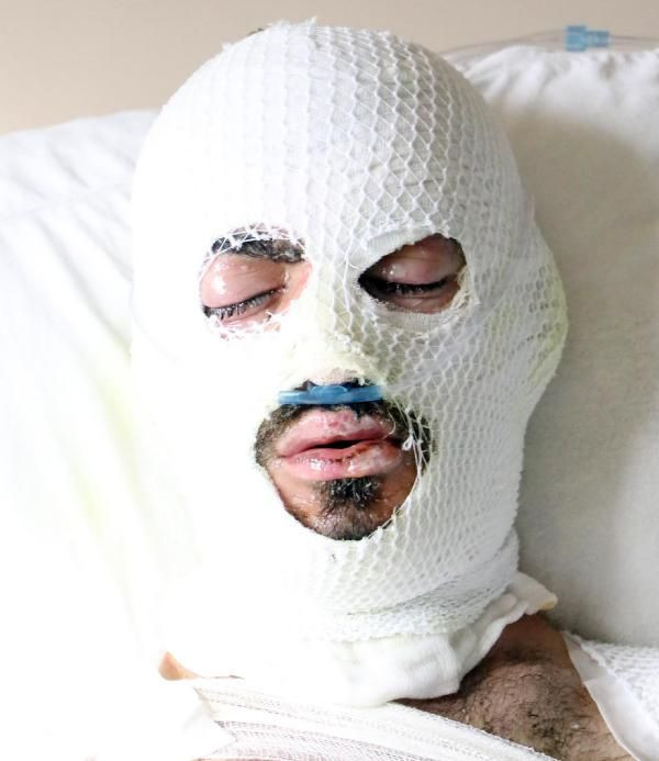 Artvin'de feci olay her şey saniyeler içinde oldu! Canlarını zor kurtardılar - Resim: 1