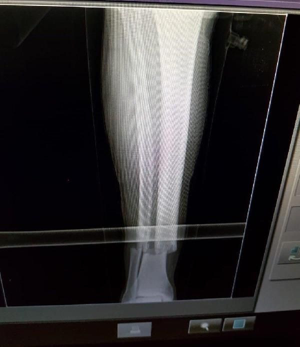 İşte Emre Akbaba'nın son durumu - Resim: 4