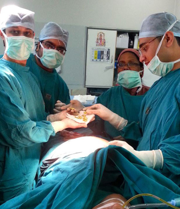 Midesinden çıkan altınlar görenleri şok etti! - Resim: 1