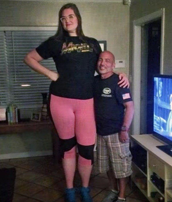 Küçükken arkadaşları dalga geçiyordu şimdi dünya onu tanıyor! - Resim: 4