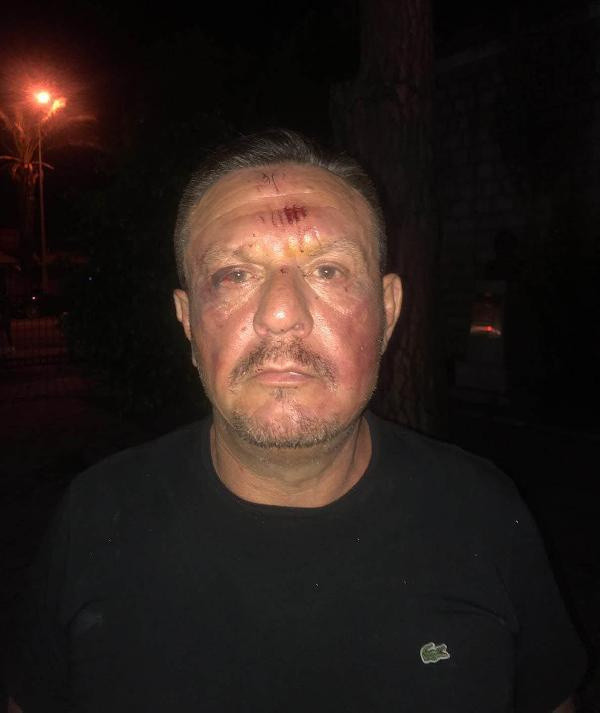 Kavgaya karışan Denizlispor Başkanı Ali Çetin ve 2 oğlu gözaltında - Resim: 1