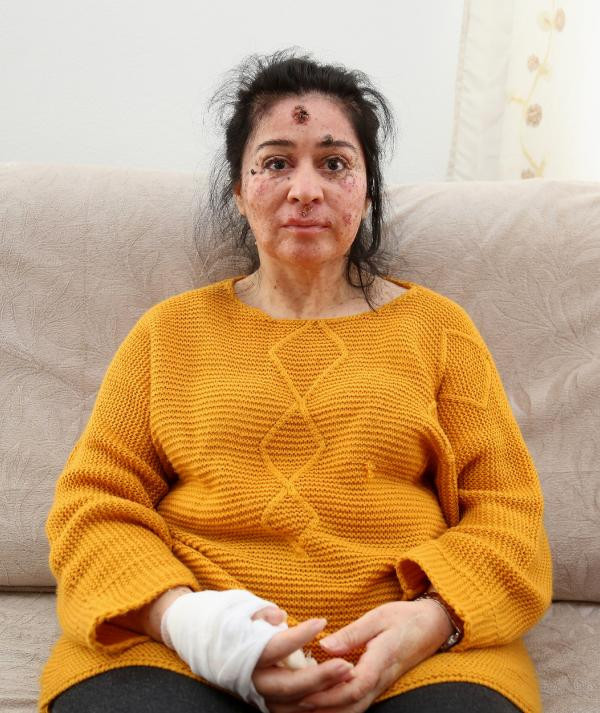 Çok nadir görülüyor! Kimse soru sormasın diye dışarı çıkamıyor - Resim: 2