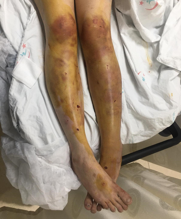 Şanlıurfa'da eşine işkence ederek bu hale getirdi! Caniyle ilgili yeni gelişme - Resim: 0