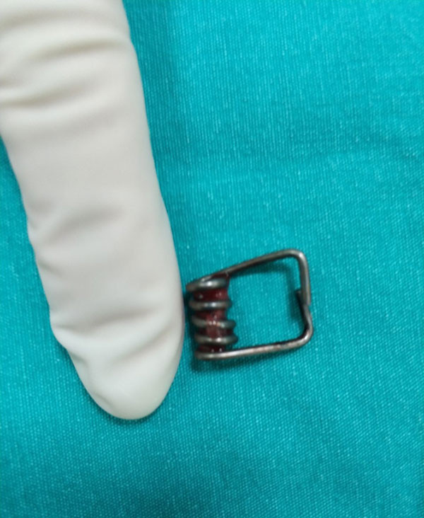 1 yaşındaki bebeğin yuttuğu şeye inanamayacaksınız filmde göründü... - Resim: 4