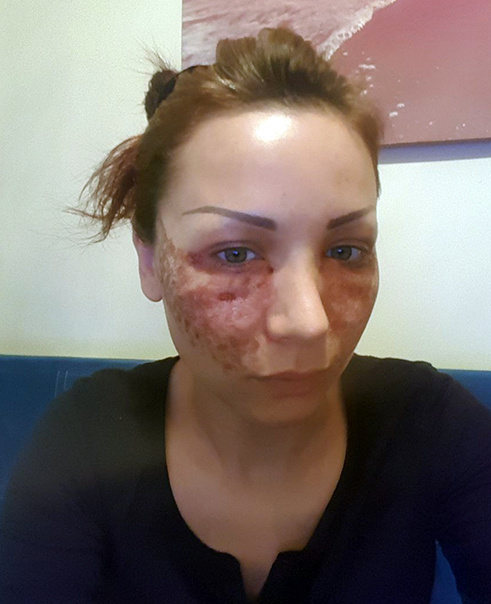İstanbul'da ilk kez karşılaştığı kadına inandı! Manken tanınmayacak hale geldi - Resim: 0