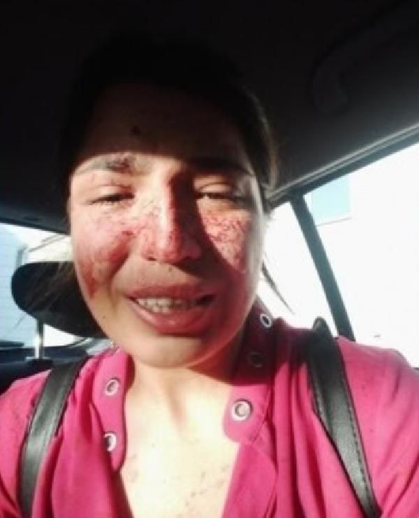 Kayseri'de boşandığı eşi dehşeti yaşattı: Ben ölmeden sesim olun - Resim: 3