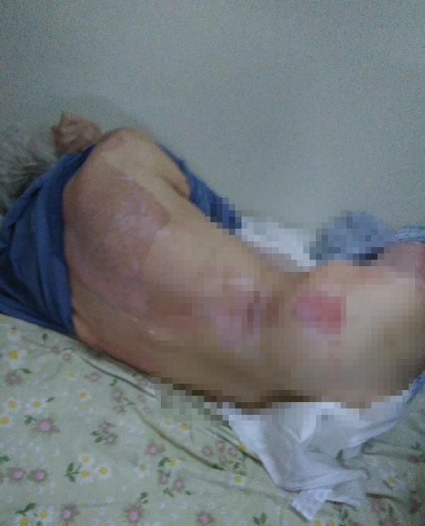 İzmir'de vahşet! Yaşlı bakım evinde banyo yaptırdıkları kadını kaynar suyla yakarak öldürdüler! - Resim: 3