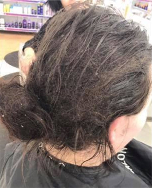 8 ay boyunca saçlarını yıkamayan kadın ancak 8 saatte... - Resim: 2