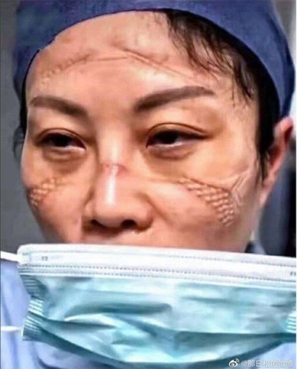 Gece gündüz çalışan Çinli doktorların içler acısı haline bakın - Resim: 2