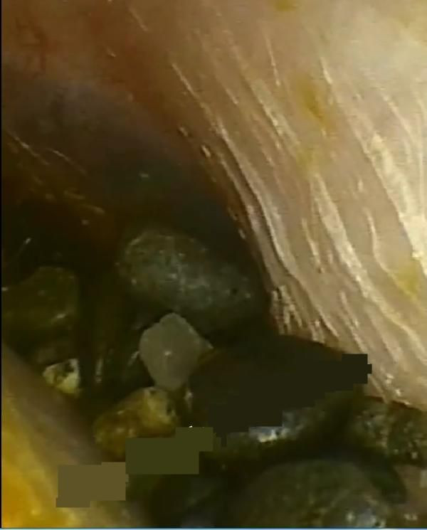 Kulaktan çıkanlara kimse inanamadı! Düzce'de doktor 17 yılda biriktirdi: Gerçekten büyüktü - Resim: 4