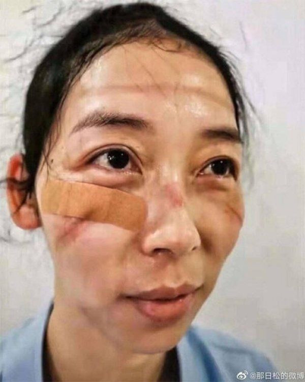 Gece gündüz çalışan Çinli doktorların içler acısı haline bakın - Resim: 4