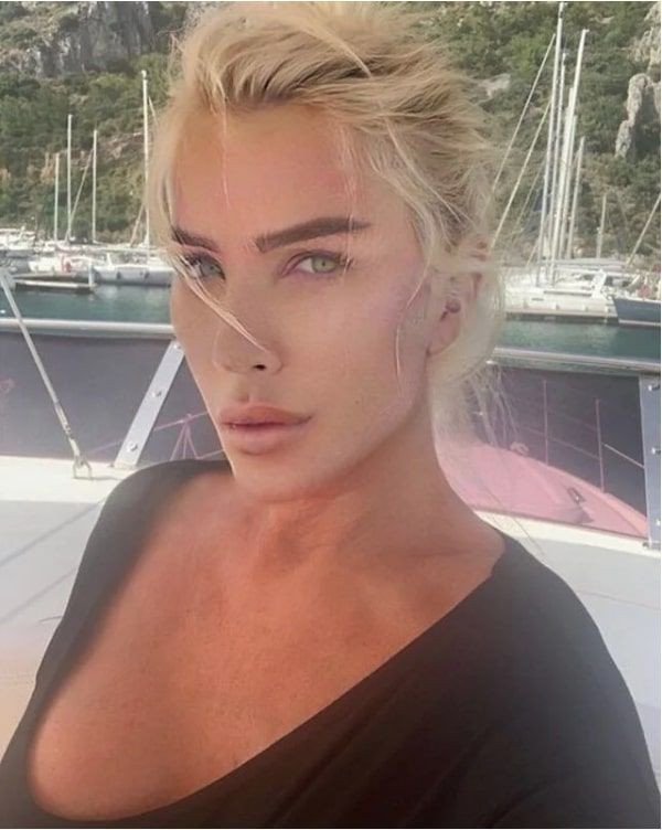 Seda Sayan'ın estetikli hali sanıldı Seren Serengil ortalığı karıştırdı - Resim: 3