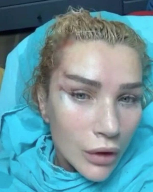 Seda Sayan'ın estetikli hali sanıldı Seren Serengil ortalığı karıştırdı - Resim: 1