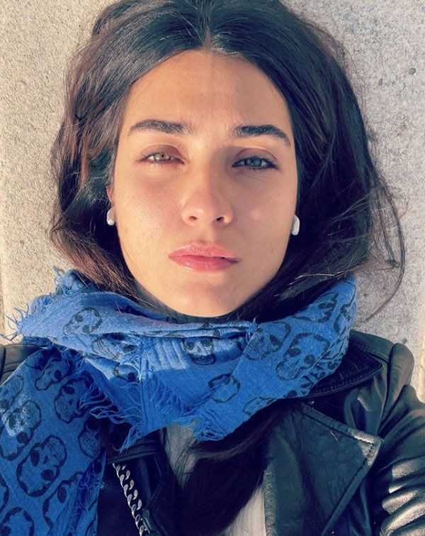 Doğal güzelliğiyle ünlüydü! Tuba Büyüküstün'de estetikliler kervanına katıldı - Resim: 1