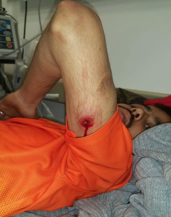 Yunan güvenlik güçleri mültecilere ateş açtı: 1 ölü 5 yaralı - Resim: 1