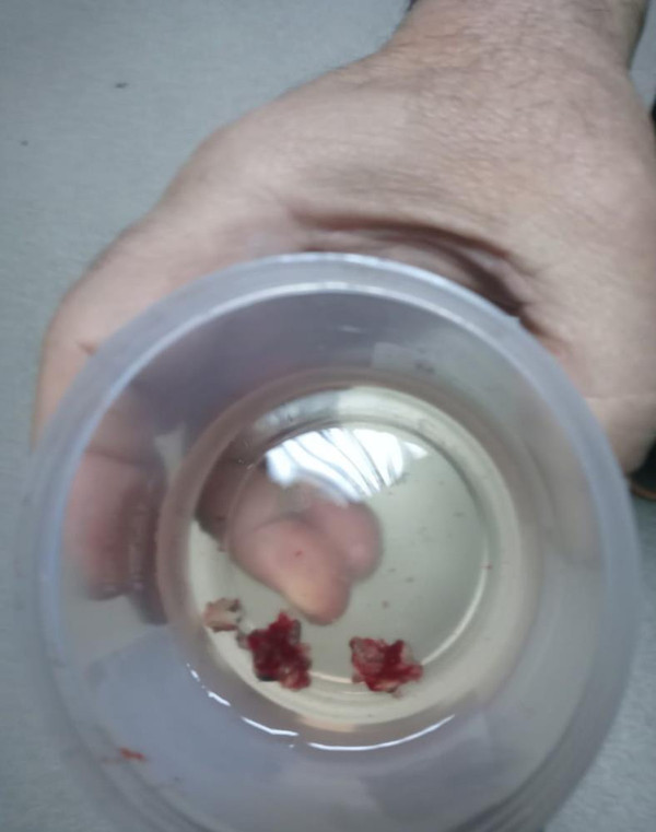 Baş ağrısı şikayetiyle hastaneye gitti! Gerçeği öğrenen doktor şaştı kaldı: Kendimi yeniden doğmuş gibi hissediyorum - Resim: 0