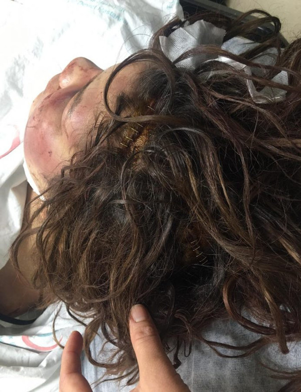 Şanlıurfa'da eşine işkence ederek bu hale getirdi! Caniyle ilgili yeni gelişme - Resim: 3