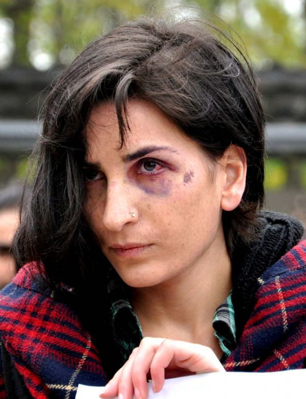 Ondokuz Mayıs Üniversitesi yine karıştı - Resim: 4