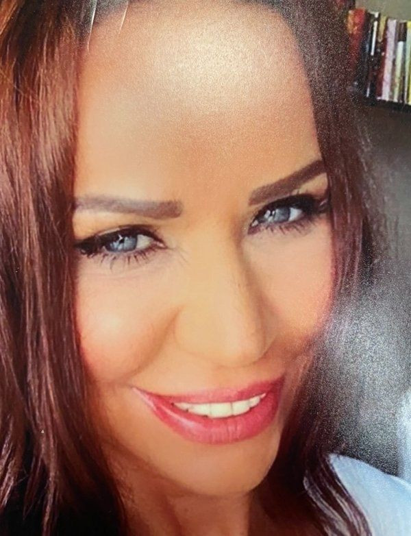 İstanbul'da estetik faciası! Lise mezunu doktor (!) tanınmaz hale getirdi - Resim: 4