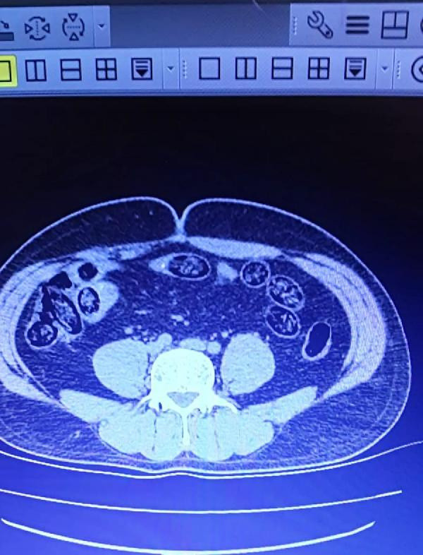 Van'da 2 İranlının midesinden çıkanlar herkesi şaşırttı! 103 tane... - Resim: 0