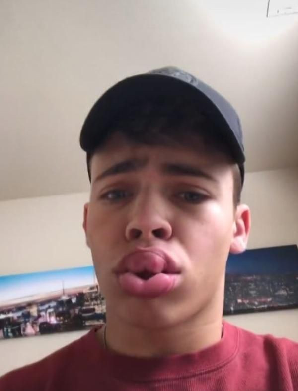 Şişeyle yapıp sosyal medyada paylaşıyorlar! 'Evde estetik' akımı tehlike saçıyor - Resim: 2