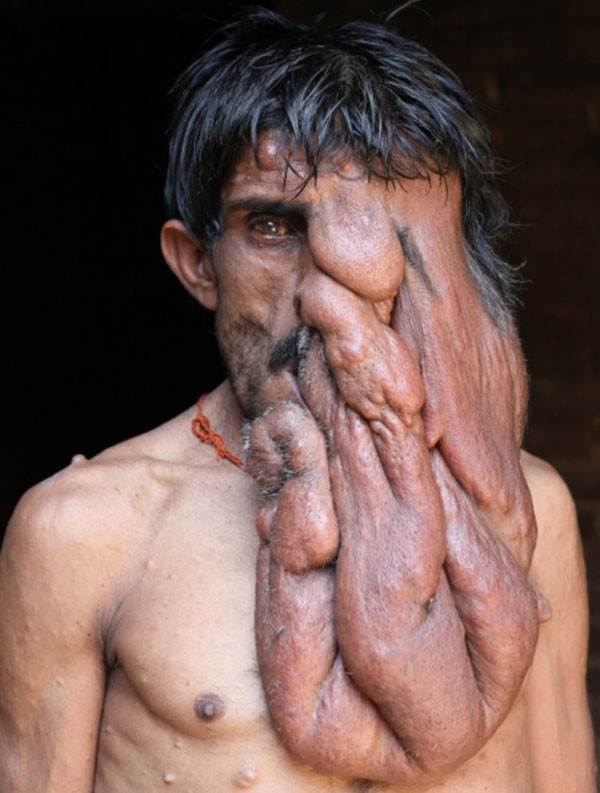 Hindistan'ın Fil Adamı Chana Lal - Resim: 4