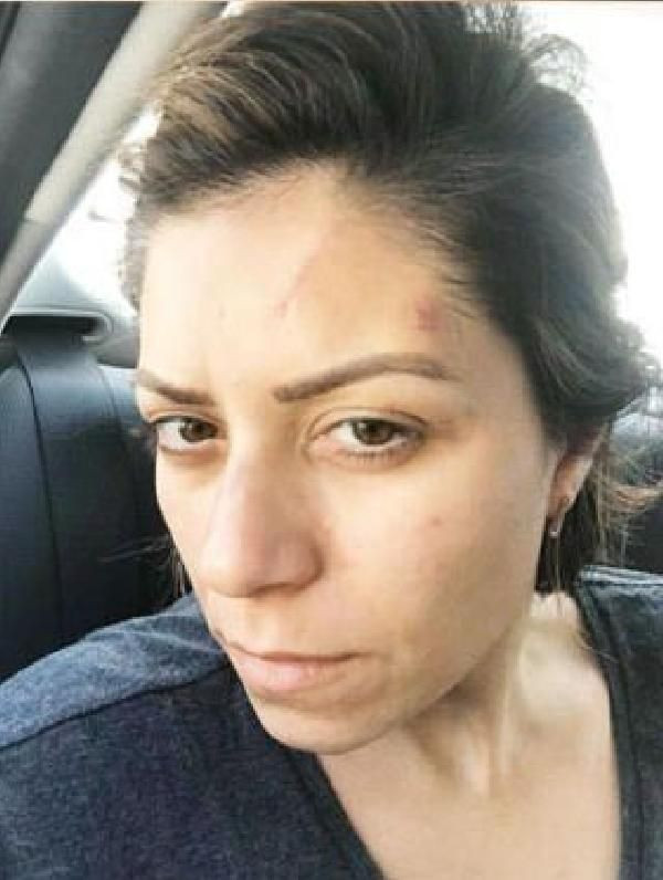 Avukatın isyanı : Eski eşim bana tecavüz etti iğrenç şeyler var - Resim: 3