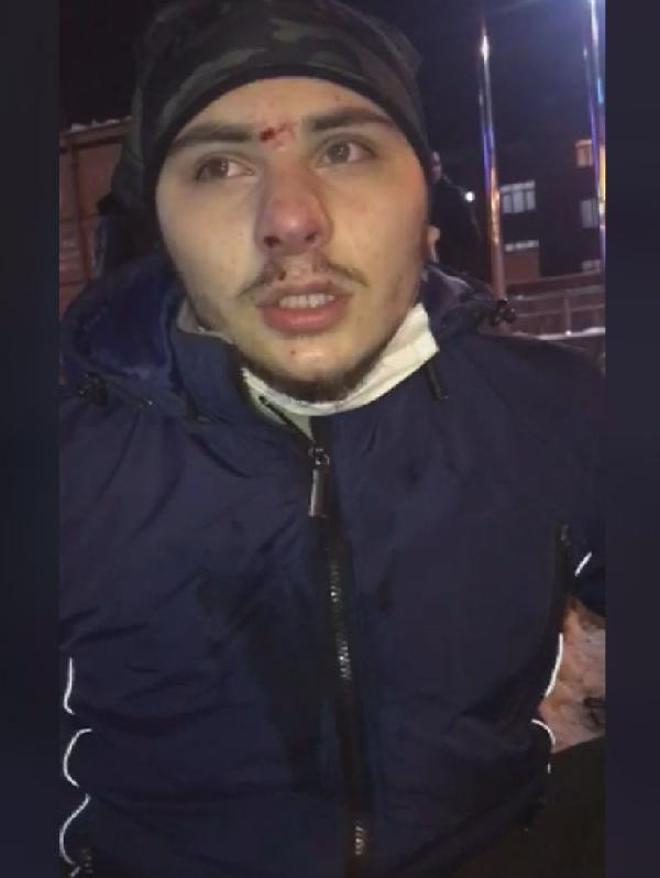 İstanbul'da buz üstünde kaydı başına gelmeyen kalmadı! Sürekli unutuyor - Resim: 0