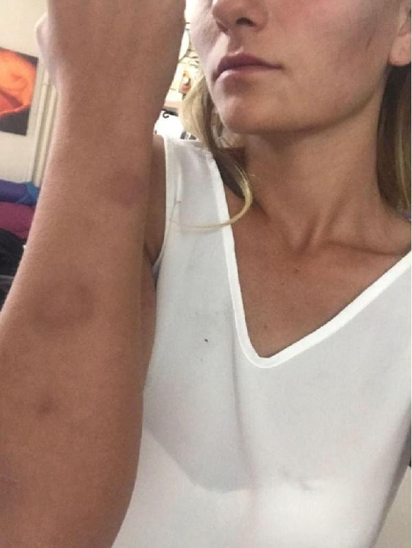 Bu ne biçim öğretim görevlisi! Öğrencisini ne hale soktu - Resim: 3