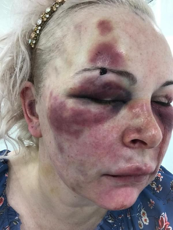 İstanbul'da otelde işkenceye uğradı kan eline bulaşınca yaladı - Resim: 4