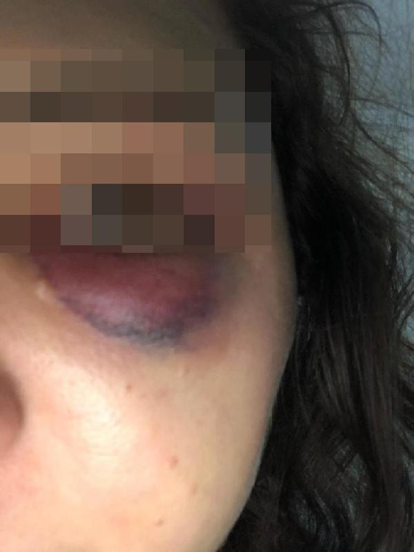 Bağcılar'da sevgilisinin evine bomba attığı kadın: Olaydan önce birçok kez tehdit etti - Resim: 0