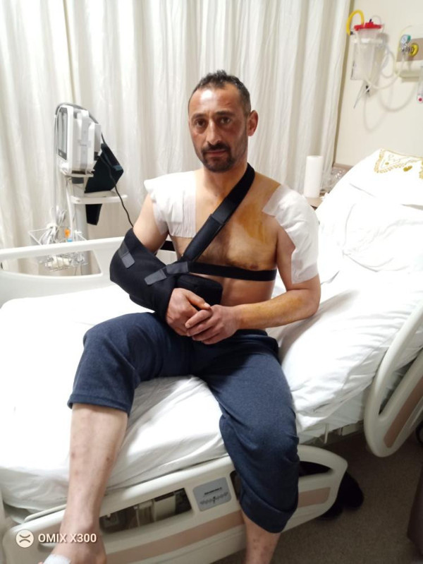 Tokat'ta domuz saldırısına uğradı kemikleri kırıldı: Gidin siz bir de domuzun halini görün - Resim: 0