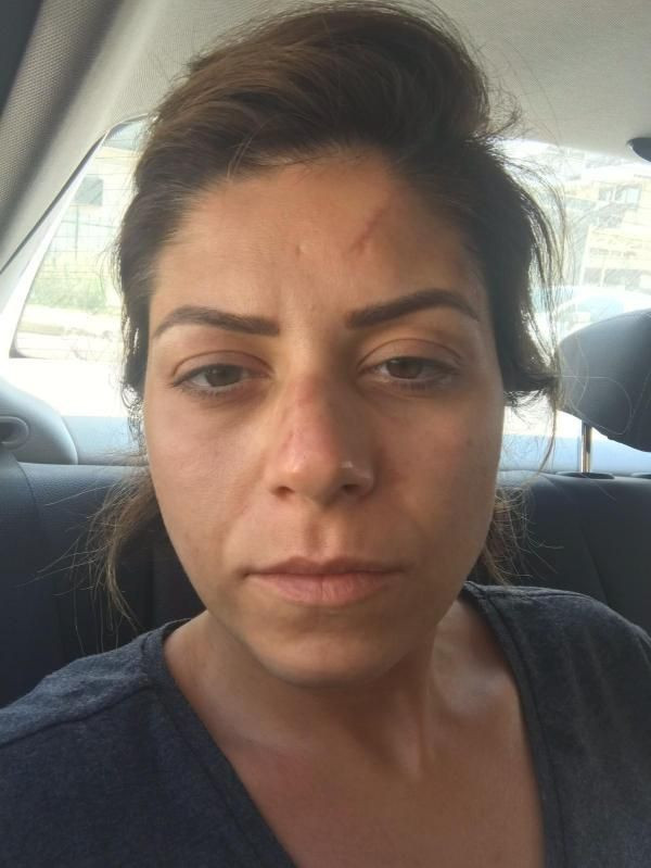 Avukatın isyanı : Eski eşim bana tecavüz etti iğrenç şeyler var - Resim: 4