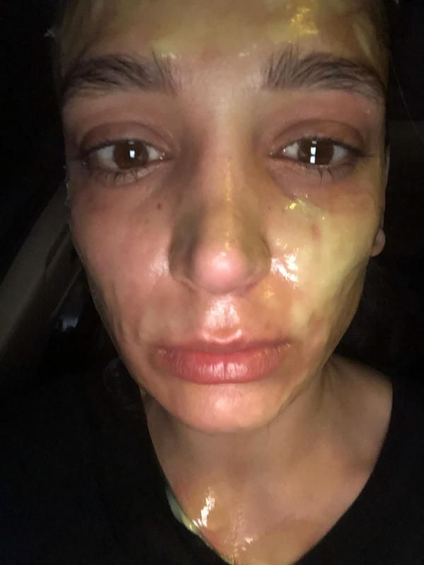 Korkunç! Tıkanan lavabosu için aldığı çözücü bomba gibi patladı - Resim: 4