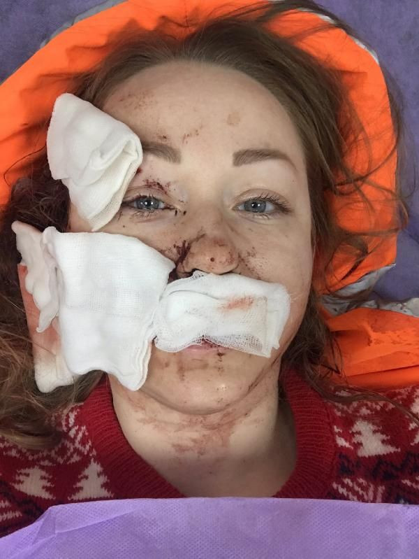 Boşanmak istediği kocası yüzünü falçata ile kesti! Anna Butim'i hala ölümle tehdit ediyor - Resim: 4