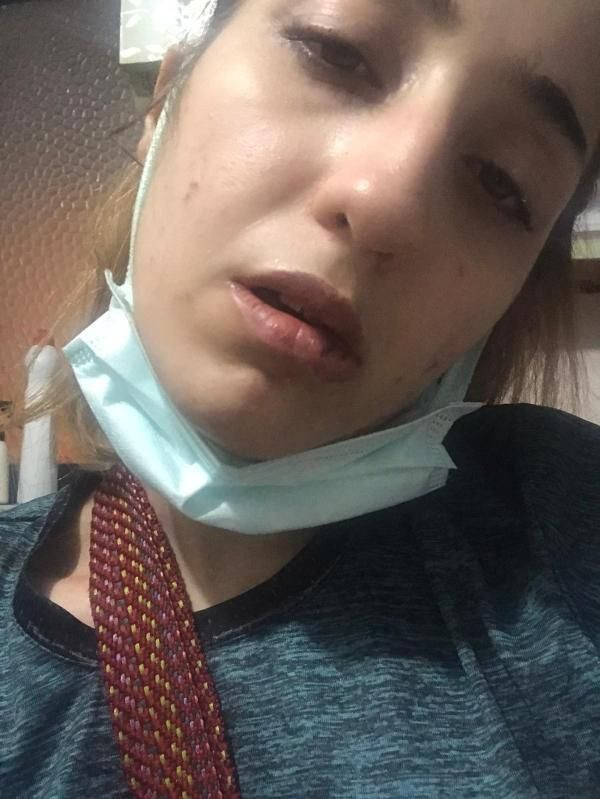 Tecavüz edip uyuşturucuya alıştırdı! Eski sevgili eve kapatıp 3 gün boyunca... - Resim: 1