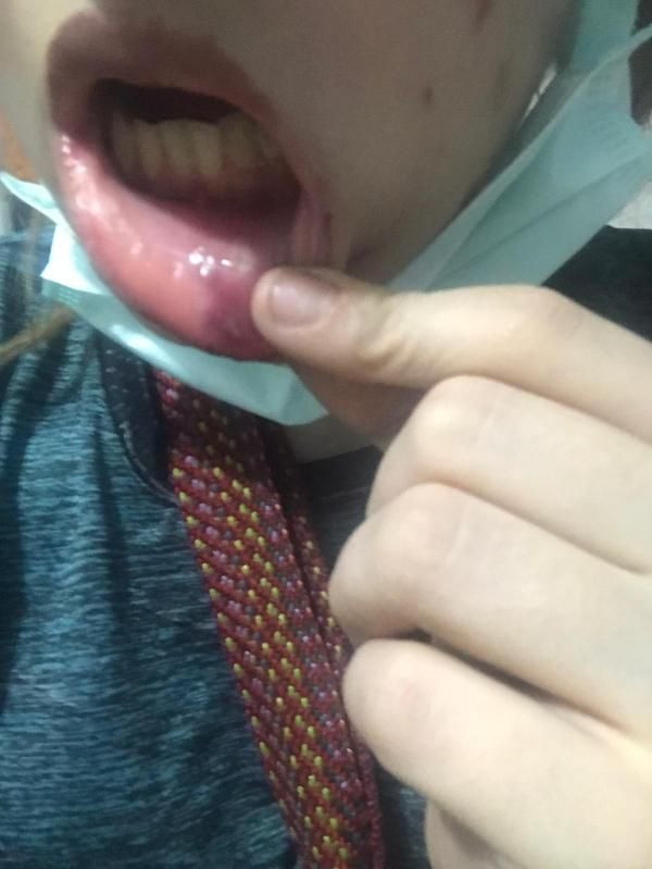 Tecavüz edip uyuşturucuya alıştırdı! Eski sevgili eve kapatıp 3 gün boyunca... - Resim: 4