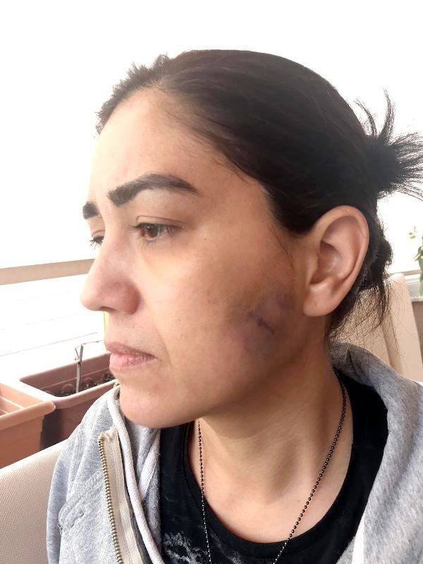 Antalya'da maganda tanımadığı 3 kadını döverek hastanelik etti - Resim: 1