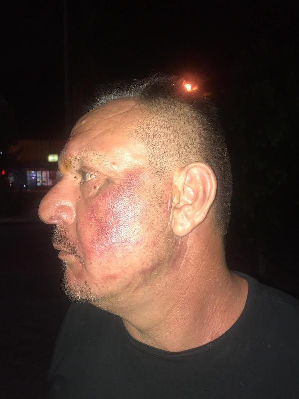 Kavgaya karışan Denizlispor Başkanı Ali Çetin ve 2 oğlu gözaltında - Resim: 2