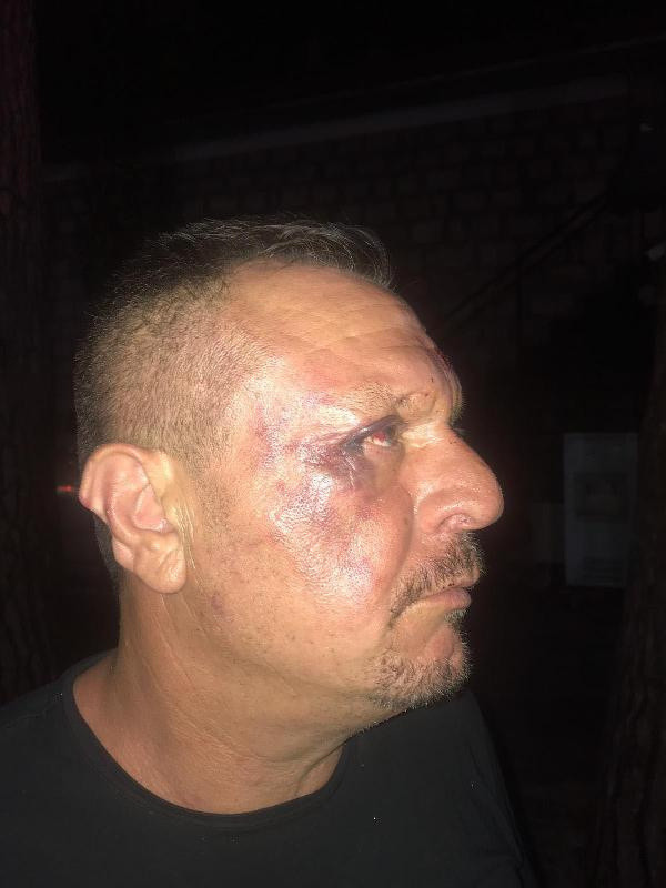 Kavgaya karışan Denizlispor Başkanı Ali Çetin ve 2 oğlu gözaltında - Resim: 0