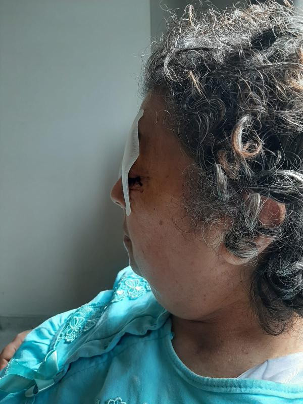 Adana'da hastanede korkunç olay oda arkadaşı gözlerini oydu - Resim: 3