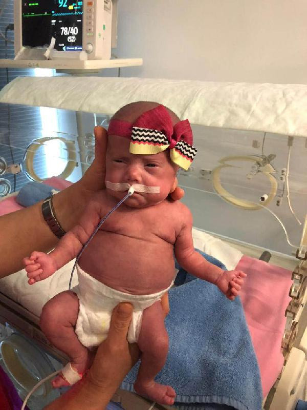 Ankara'da 490 gram ve 680 gram doğdular! Mucize oldu işte son halleri - Resim: 1