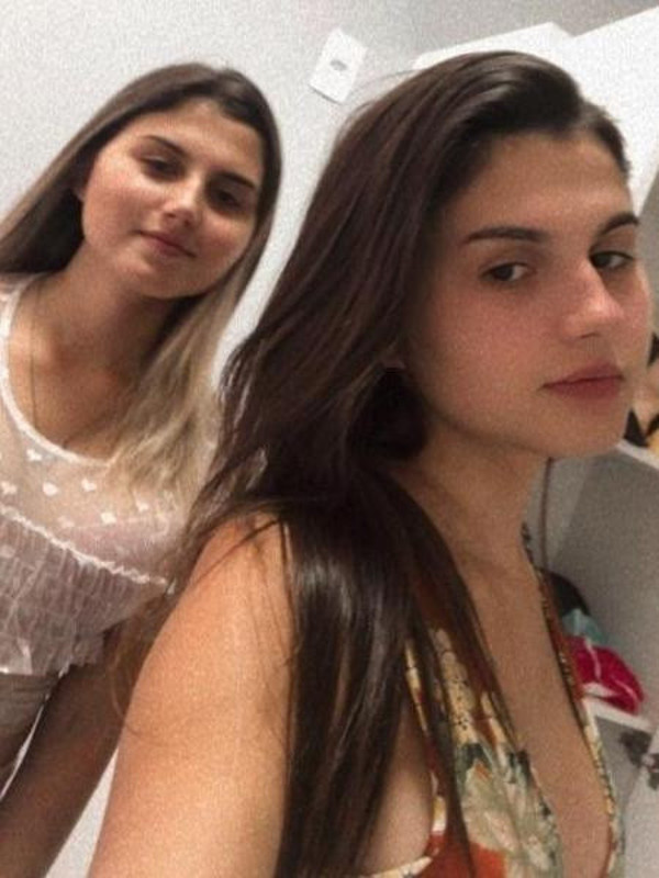 Dünyada bir ilk ikizler aynı anda cinsiyet değiştirdi! Son halleri olay oldu - Resim: 1