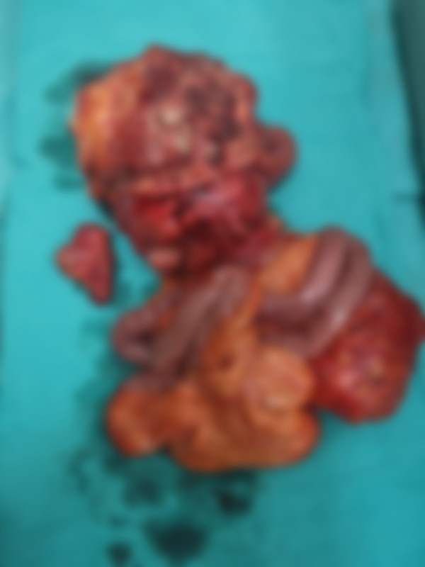 Denizli'de karın ağrısıyla gitti gerçeği öğrenince şok oldu! Karnından dışarı sarkmış... - Resim: 0