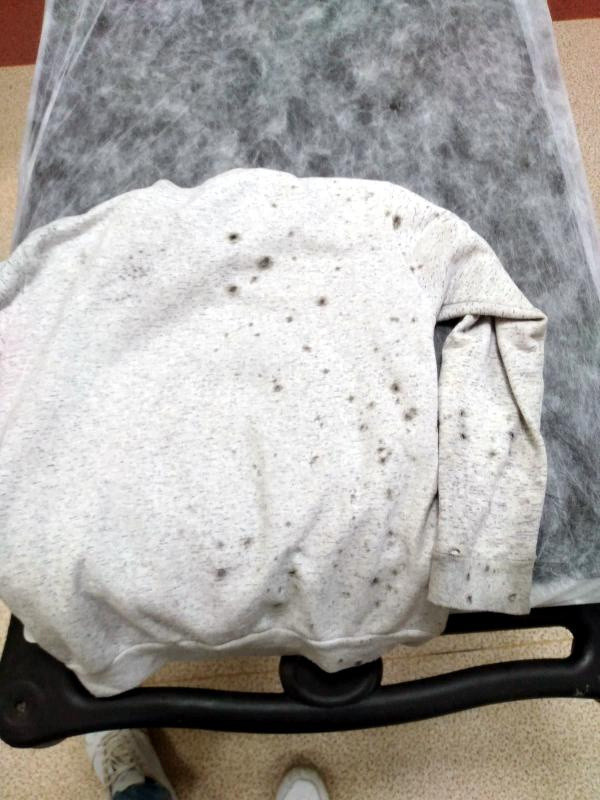 Adana'da oyun oynarken arkadaşı bu hale getirdi! Kıyafetleri bile delik deşik - Resim: 0